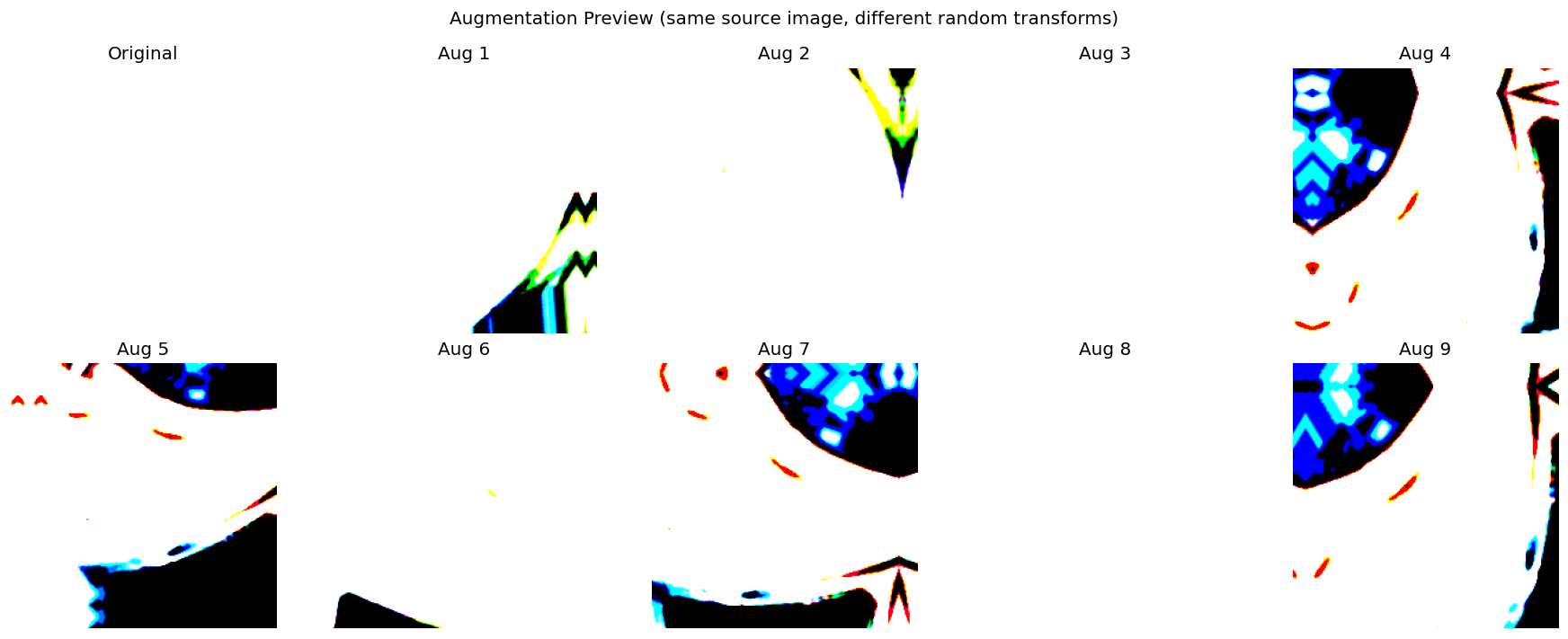 Augmentation